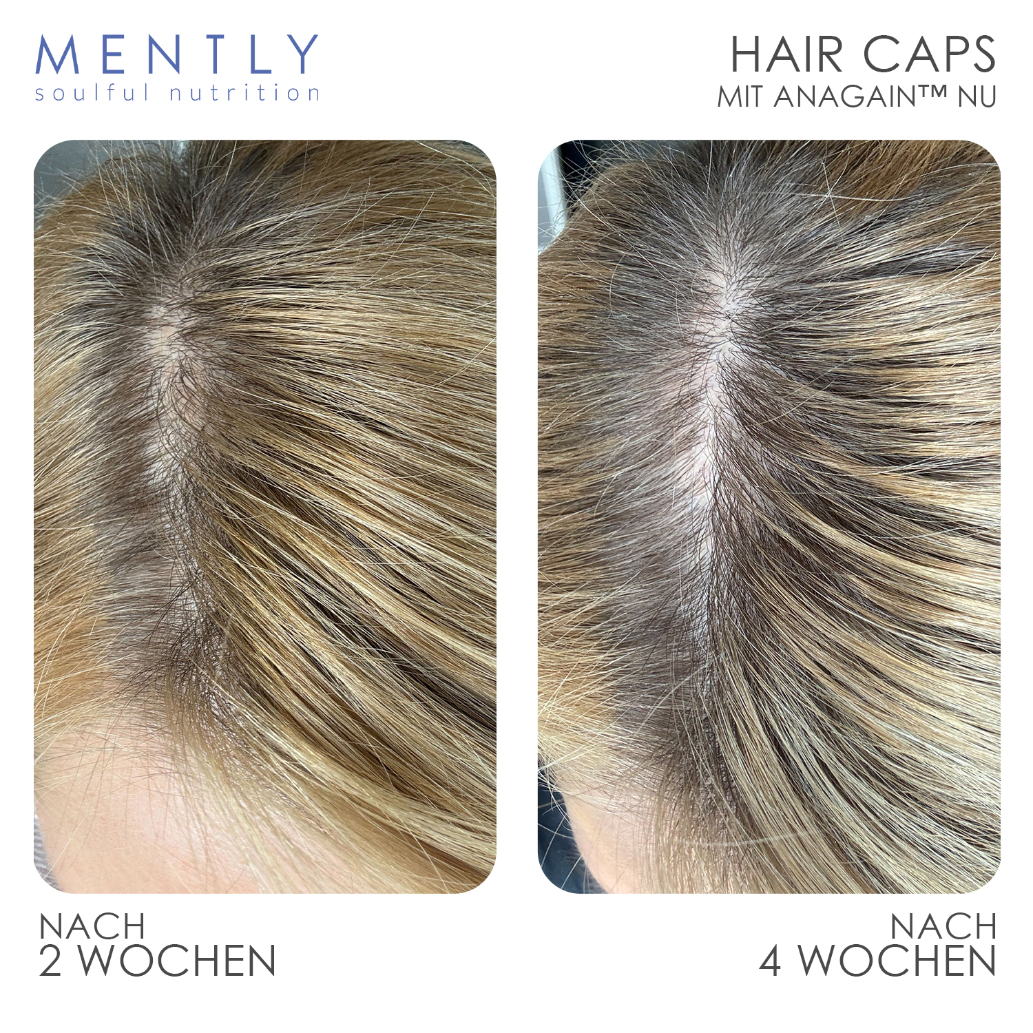 Hair Caps Hair Caps